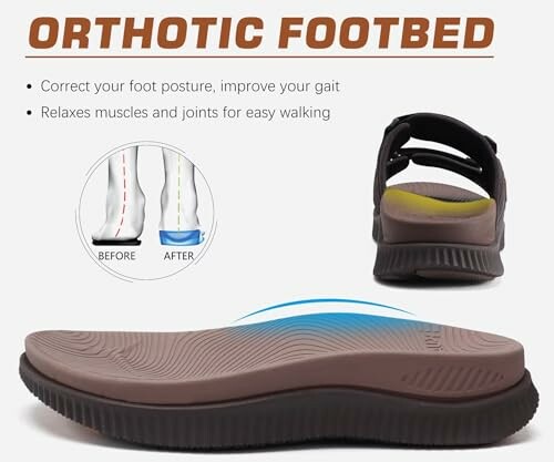 Orthotic footbed sandal with before and after posture improvement illustration.